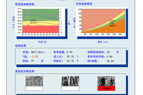 骨密度正常值對照表